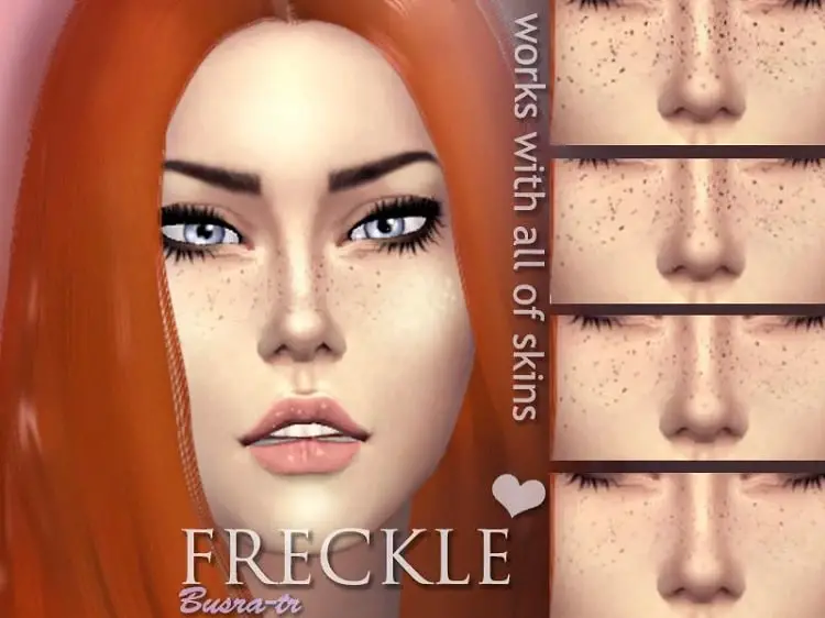 Frecklex
