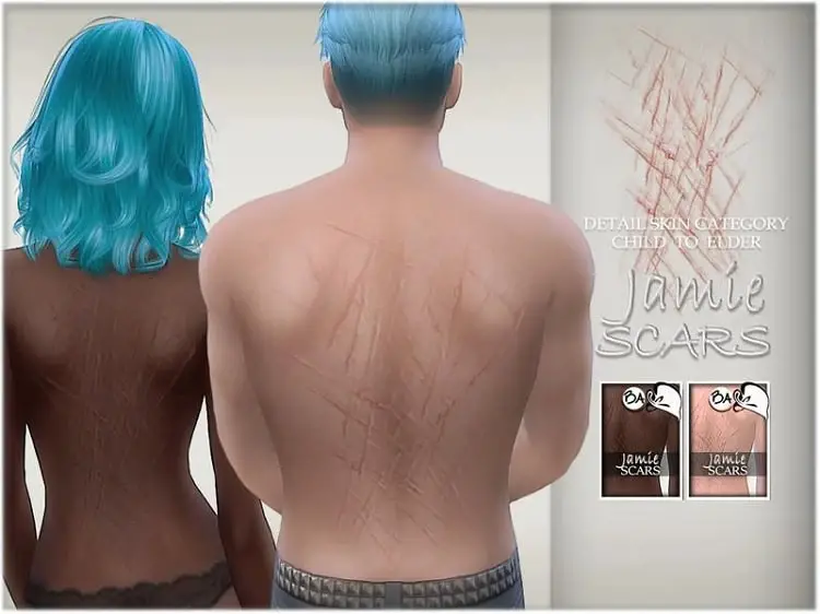 Jamie's Back Scars